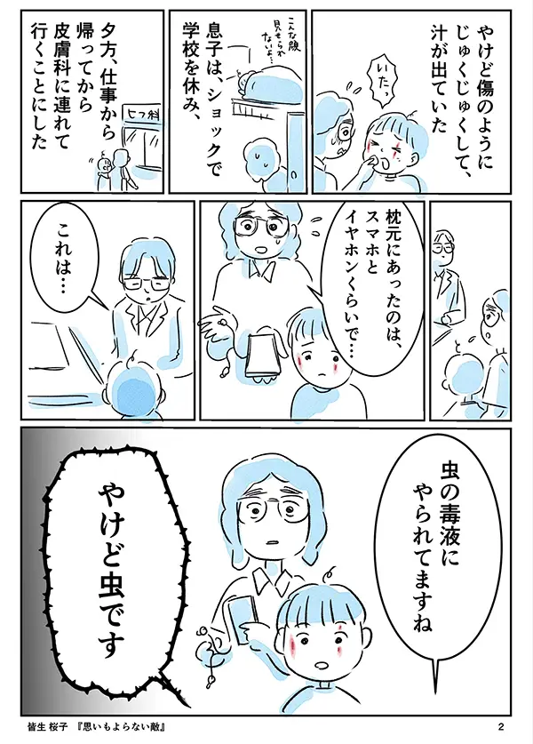 やけど虫の注意喚起のエッセイ漫画