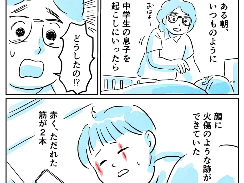 やけど虫の注意喚起のエッセイ漫画