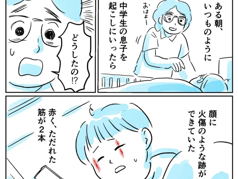 やけど虫の注意喚起のエッセイ漫画